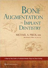 کتاب Bone Augmentation in Implant Dentistry: A Step-by-Step Guide to Predictable Alveola